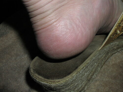 The heel of my foot