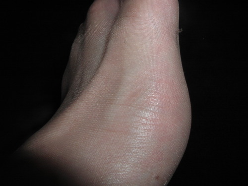 Side of my foot